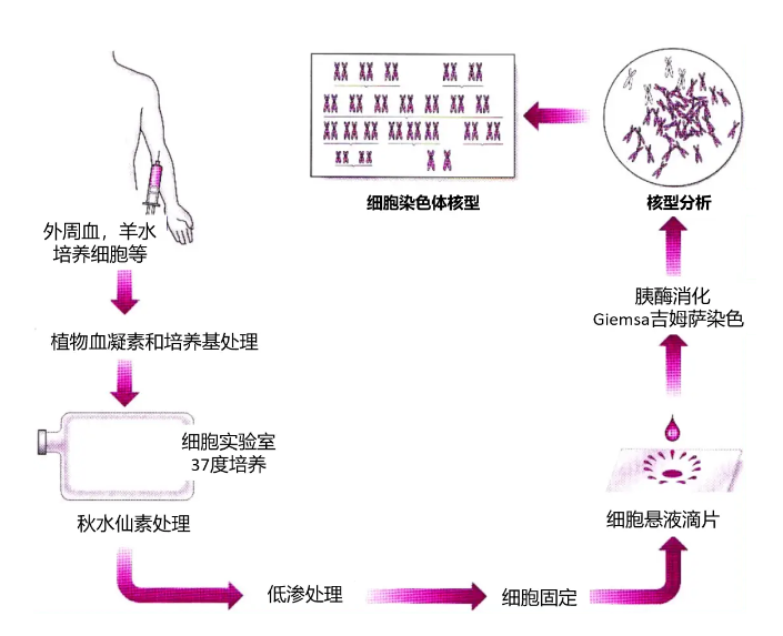 胎停后要进行染色体分析