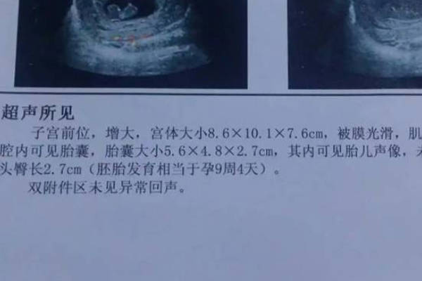 怀孕三个月后宝宝不会发生胚胎停育