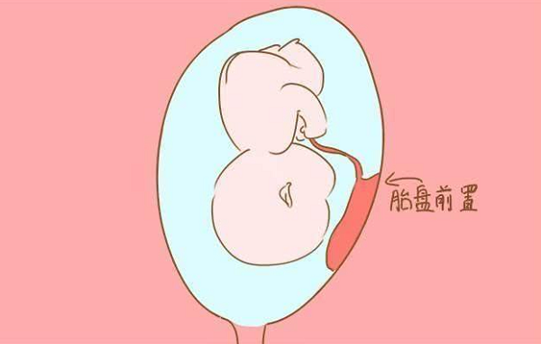 怀孕胎盘位于子宫前壁男孩多还是后壁多呢?