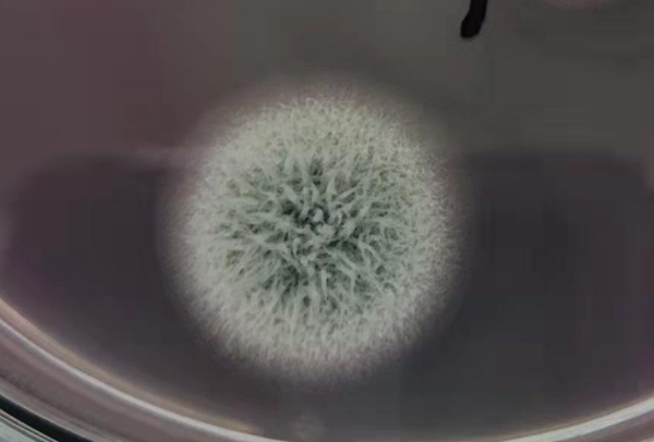 霉菌检测的方法有三种