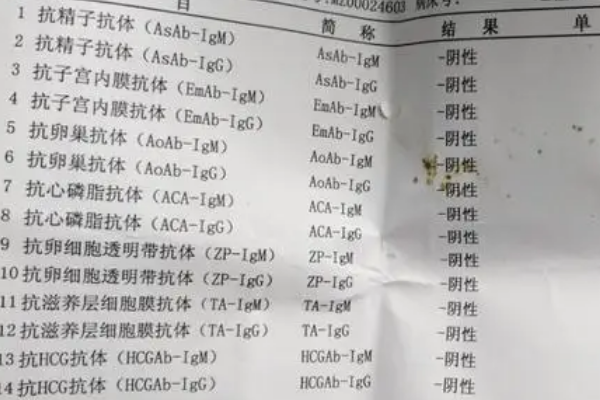 抗卵巢抗体检查需要20元
