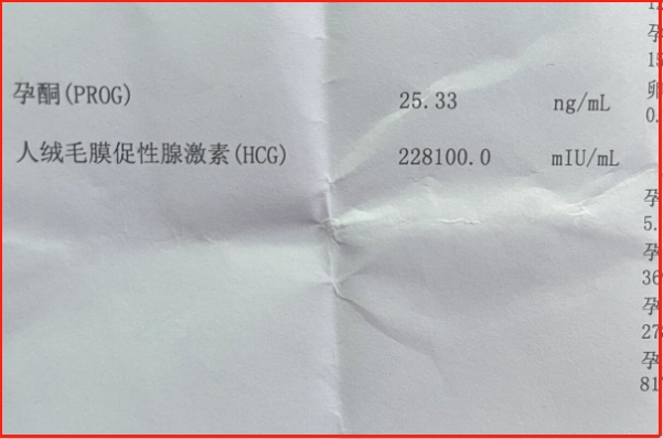 胚胎移植后14天可以测hcg