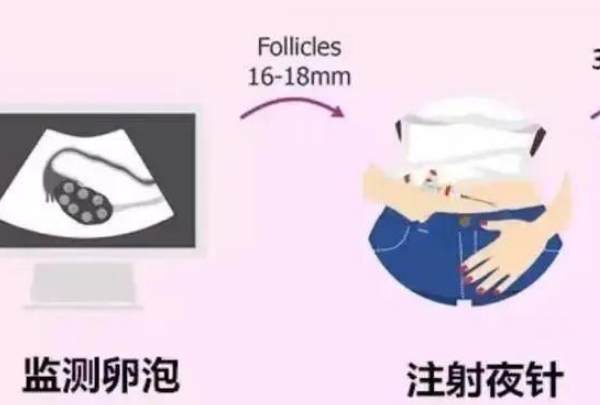 试管婴儿长方案，近年数据揭示的高效之路