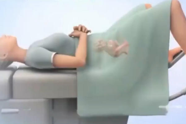 试管流程一般需要两道三个月