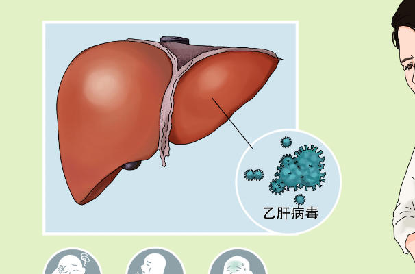 备孕检查男方和女方都要做乙肝病毒检查