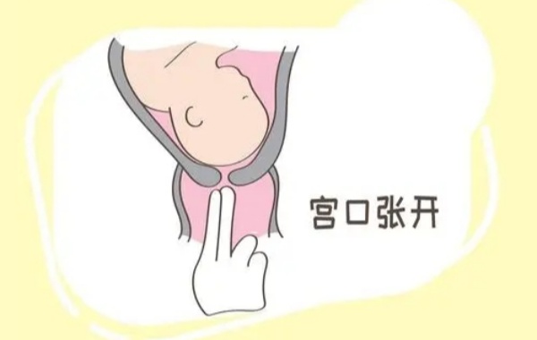 首次顺产开宫口是前三指疼还是后面疼呢？