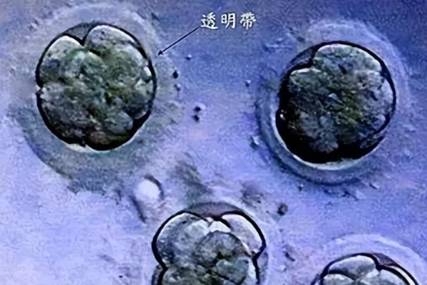 卵泡的质量会影响胚胎的数量