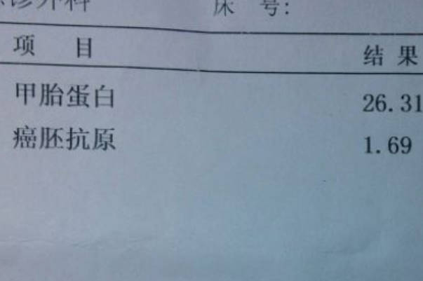 去消化内科做甲胎蛋白检查费用大概是多少钱一次？