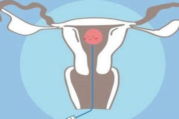 年龄会影响胚胎的成活率