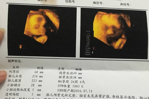 女性若是有子宫肌瘤不利于胚胎生长
