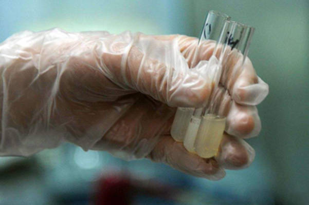 去上海人类精子库买精子做供精人授要满足哪些条件？