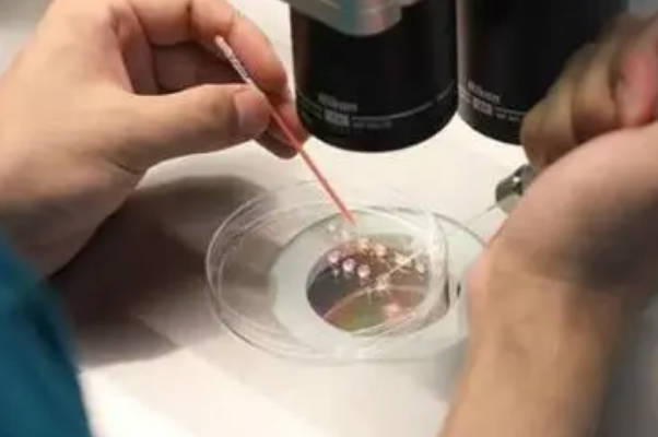 子宫内膜存在问题导致移植失败