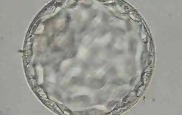 做二代试管移植第5天囊胚4bb的成功率高吗？