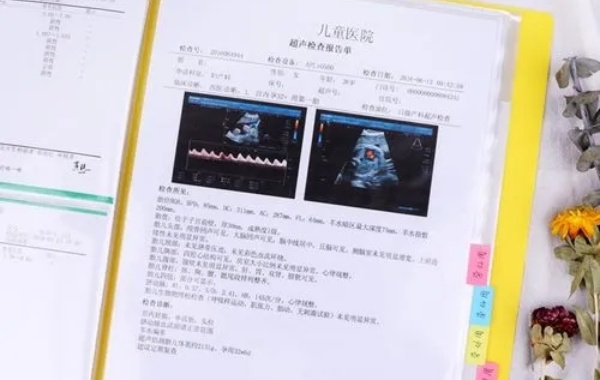 孕检单上不会有任何关于男宝和女宝的信息