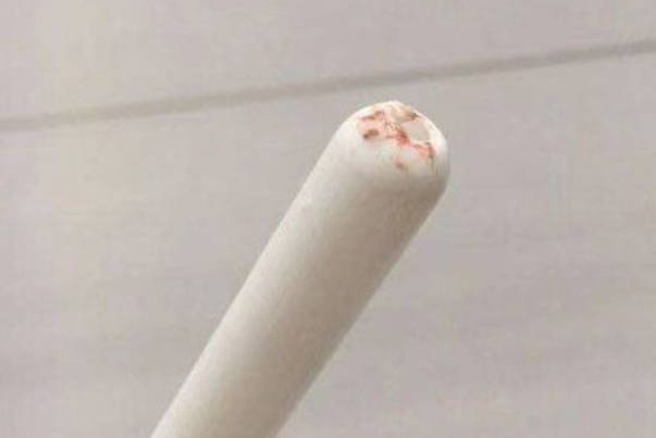 雪诺酮药物塞得过深管子上就会有血