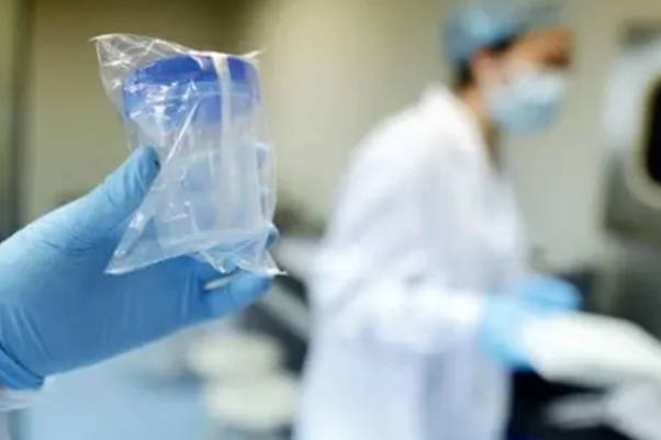 人工授精的费用大概要1万元左右