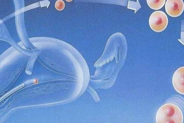 一代试管前期要先完善术前检查