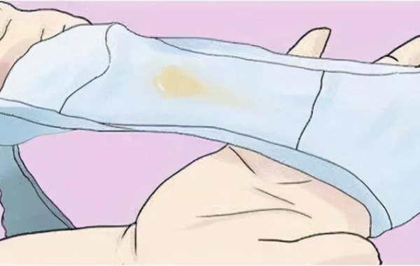 30岁女性中度宫腔粘连排出来的分泌物图片是什么样呢？