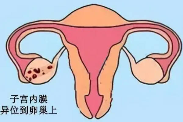 内膜9mm时移植胚胎的成功能达到55%