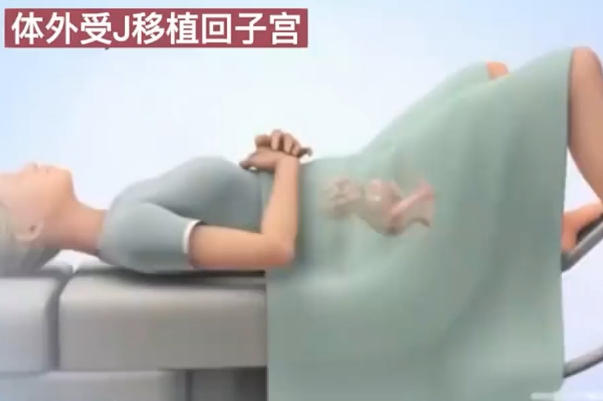 胚胎移植后不能过度劳累