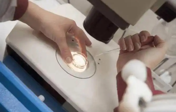 32岁女性宫角轻微粘连做一代试管移植后影响着床吗？