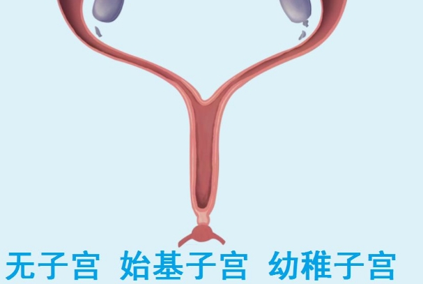 始基子宫与幼稚子宫在生育能力上有差异