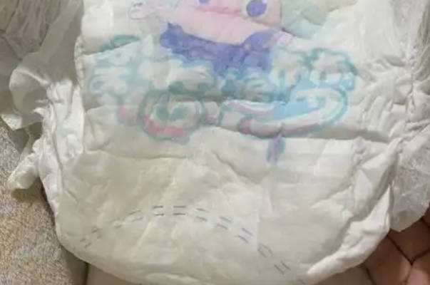 婴儿对纸尿裤过敏的症状图解，有出血、小疙瘩要警惕
