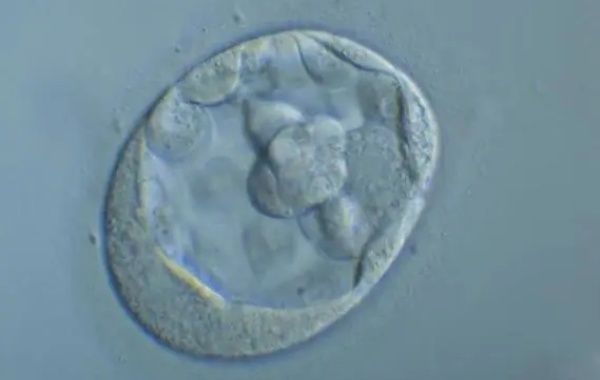 囊胚4bb试管移植四天后腹部一直有姨妈感正常吗？