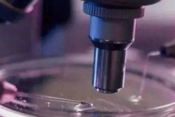 精子检查正常值参照表：活动力C级积极治疗仍能生育