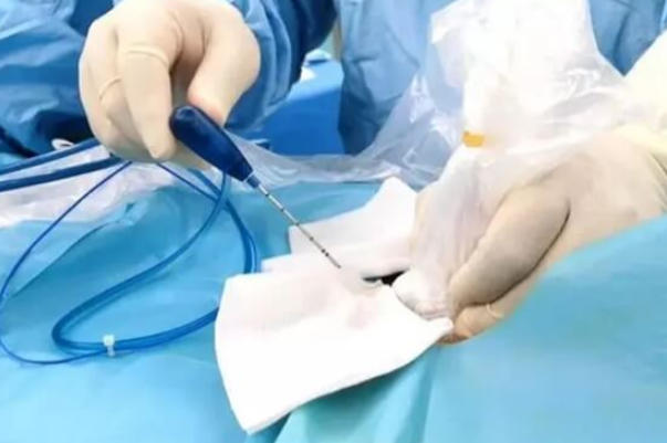 宫腔灌注后至少隔一天移植胚胎