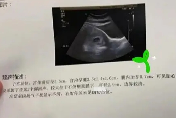 通过二代试管怀上的宝宝过了一超的成功率一般是多少？