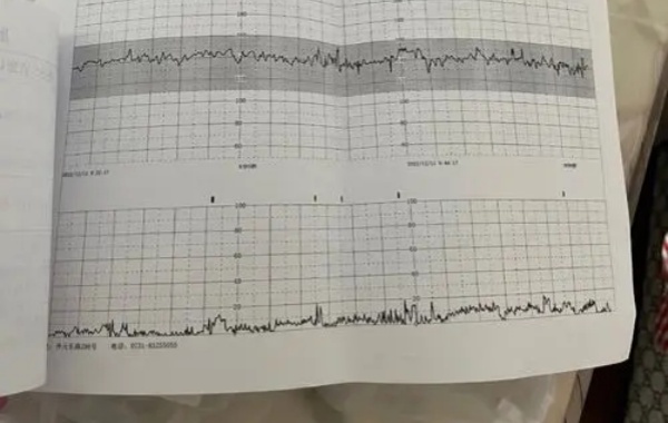 网传怀孕三个月胎心160绝对是女孩可信吗？