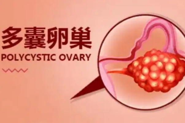 多囊促排药谨遵医嘱
