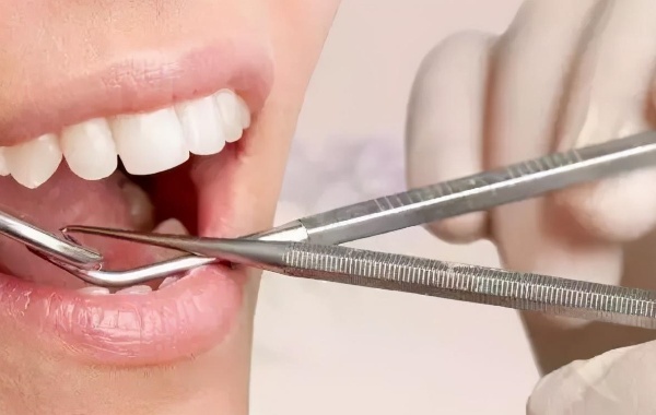 女性拔完牙最快多久可以做二代试管促排卵治疗呢？