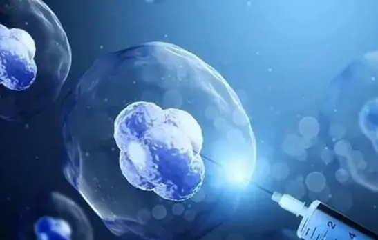 移植费用的价格一般在几千元到上万元