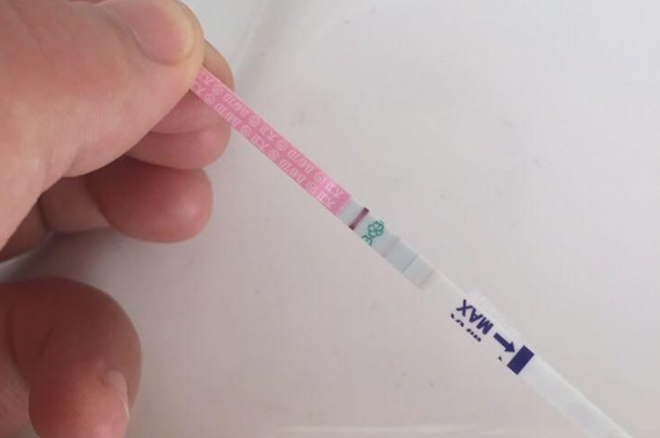 临床上重度焦虑症有做试管移植成功的吗？