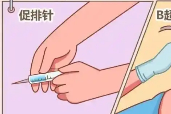 年龄会影响促排卵针的次数