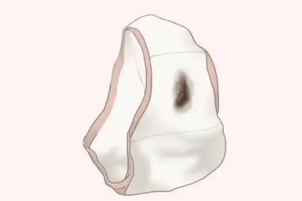 孕早期有褐色血出现说明胚胎已经生化吗？
