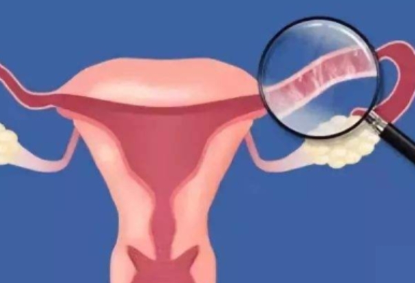 供精试管前女性需要做输卵管通畅检查吗？