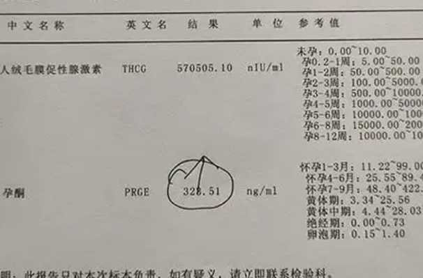 试管移植后10天血值对照表解读，你的HCG数值达标了吗