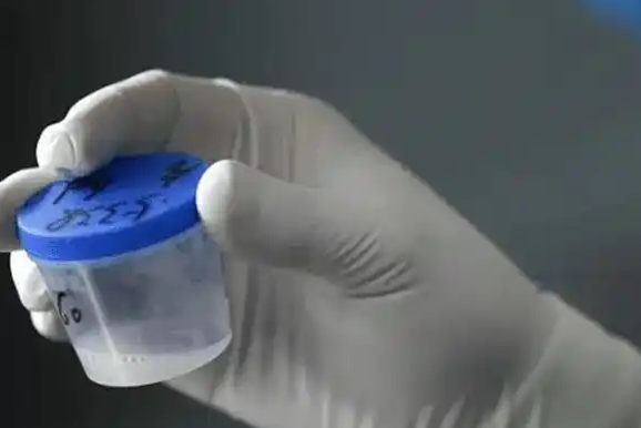 取精过程应在专业医生的指导下进行