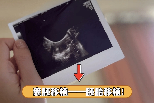 个体差异会影响移植失败后再次促排
