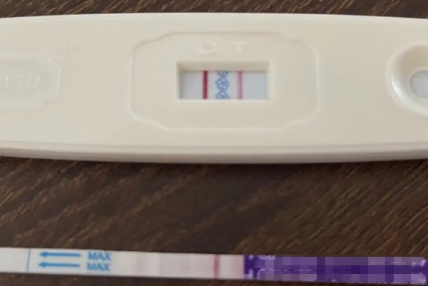 试管囊胚移植第五天能用早孕试纸测出来一深一浅两条杠吗？