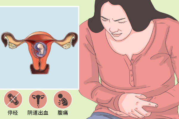 女性患习惯性流产会月经不调