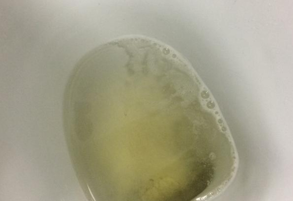 宝宝尿液是红色就不正常