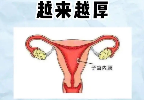 子宫内膜厚度达到17mm不刮宫可以直接移植囊胚吗？