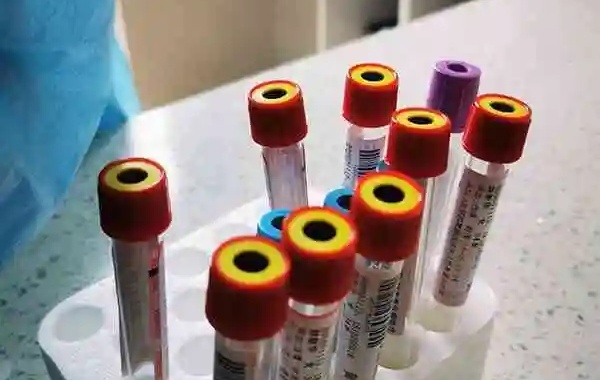 试管促排期间雌二醇对照表分享，是否正常看了就知道
