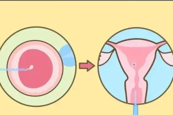 胚胎移植后泡脚水不能太热