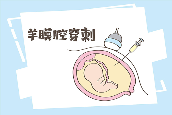 通过pgs试管怀上的孩子不做羊水穿刺检查可以吗?