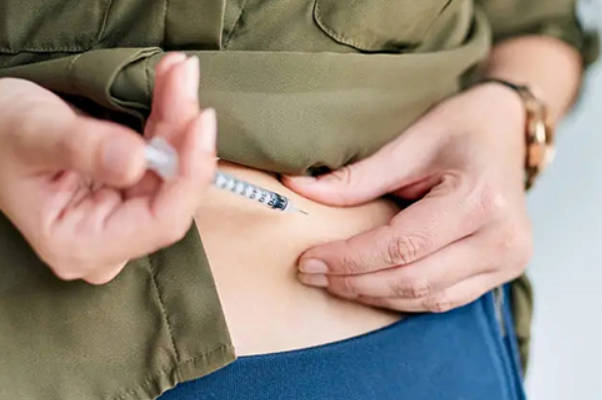 供卵试管婴儿不需要进行降调促排